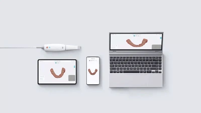 Escáner intraoral 3D Clínica Dental Savar